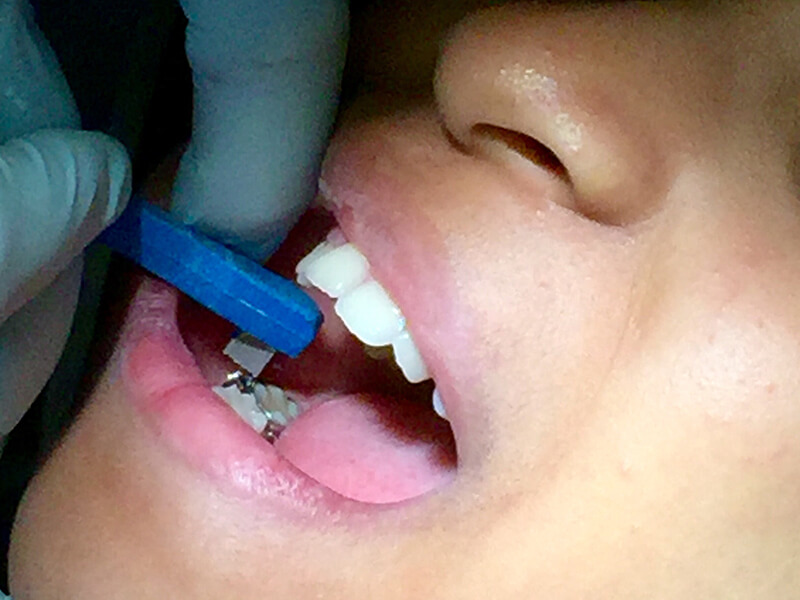 dentística